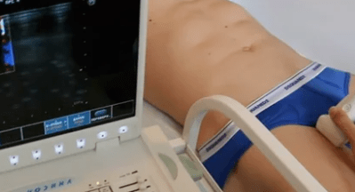 Diagnostic options for varicose veins from the lower ends